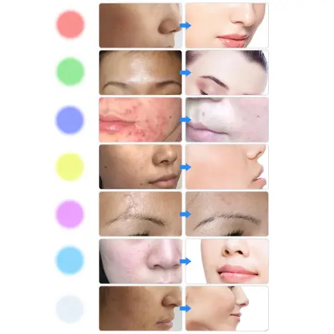 Masque de luminothérapie - Lumière rouge - vue 8